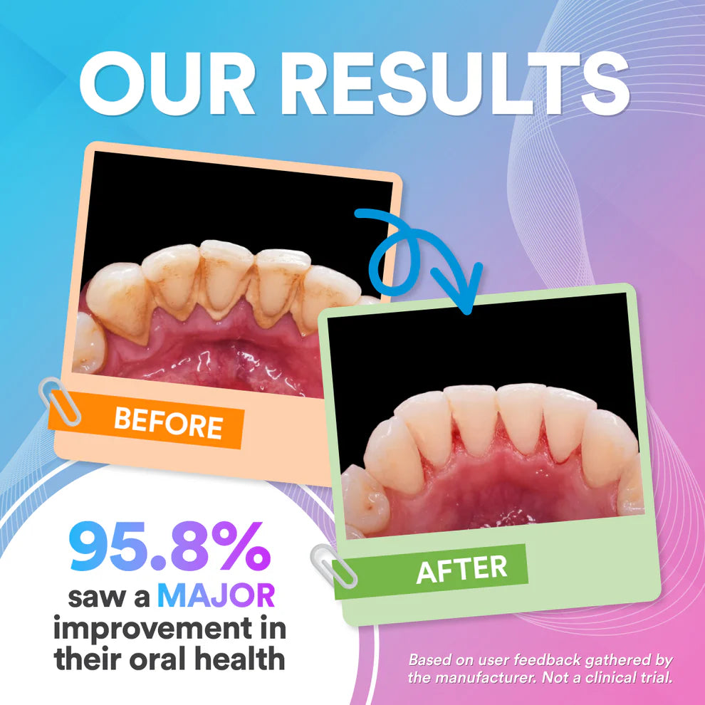 Dental Water Flosser Pro
